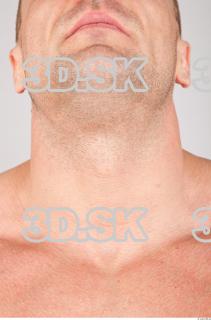 Neck texture of Gene 0001